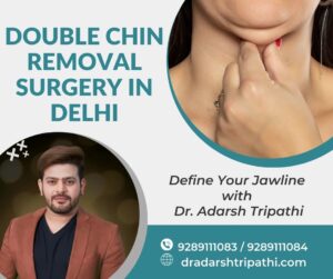 Read more about the article Double Chin Removal Surgery in Delhi: Define Your Jawline with Dr. Adarsh Tripathi
