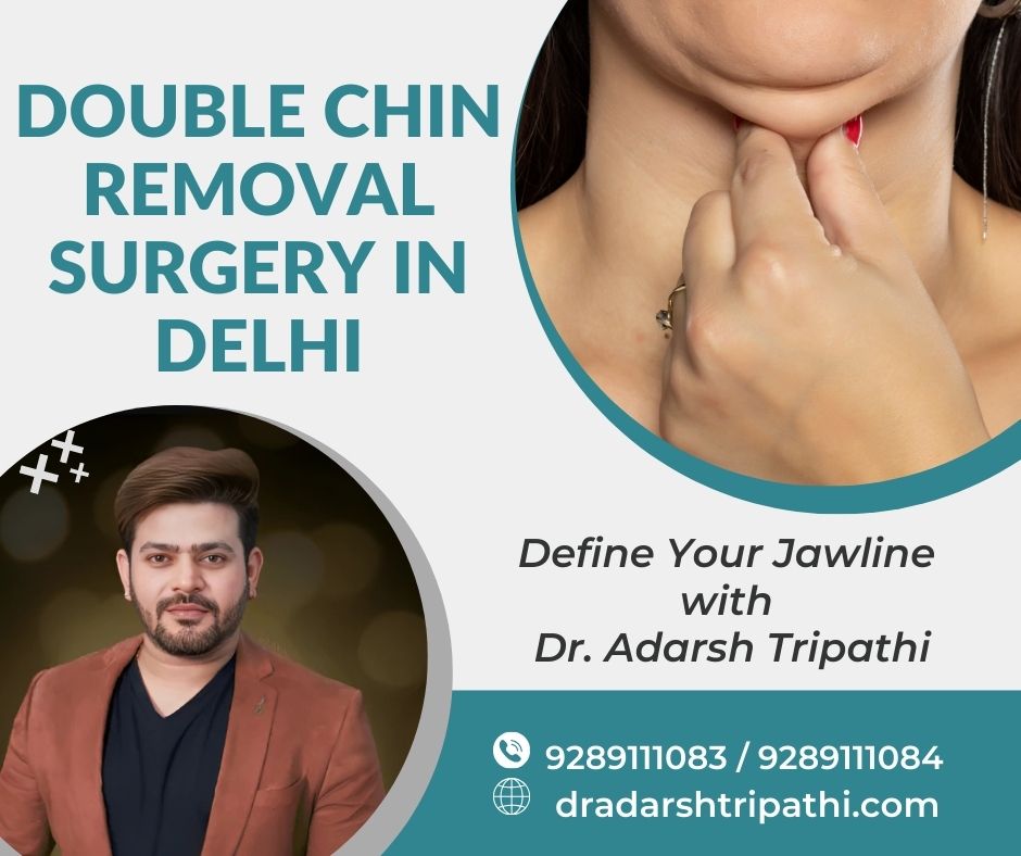 Before-and-after image showing double chin removal results by Dr. Adarsh Tripathi with Double Chin Removal Surgery in Delhi