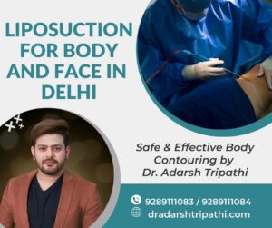 Read more about the article Liposuction in Delhi: Safe & Effective Body Contouring by Dr. Adarsh Tripathi