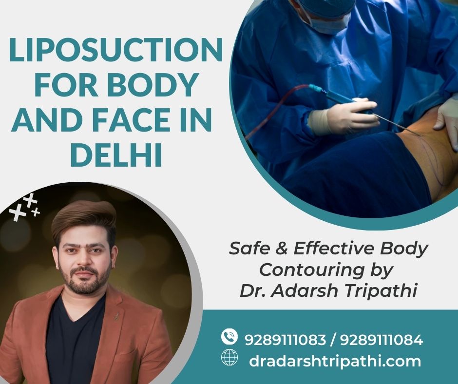 Before-and-after comparison of liposuction results performed by Dr. Adarsh Tripathi in Delhi