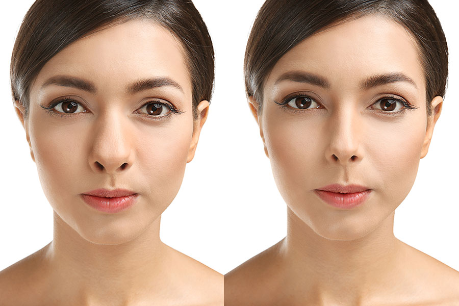 Alarplasty treatment in Delhi – Sarayu Clinic advanced facilities