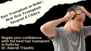 Read more about the article Hair Transplant in Delhi – Restore Your Confidence with Dr. Adarsh Tripathi