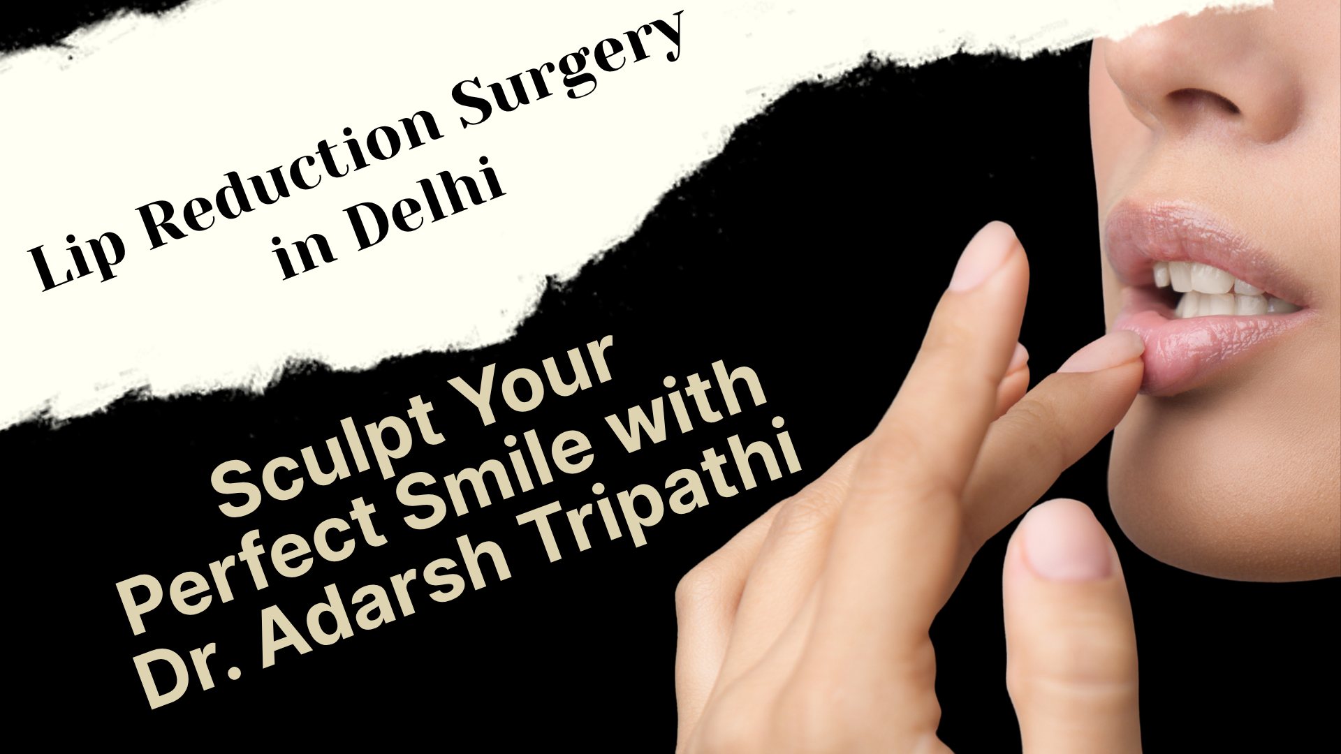 You are currently viewing Lip Reduction Surgery in Delhi – Sculpt Your Perfect Smile with Dr. Adarsh Tripathi