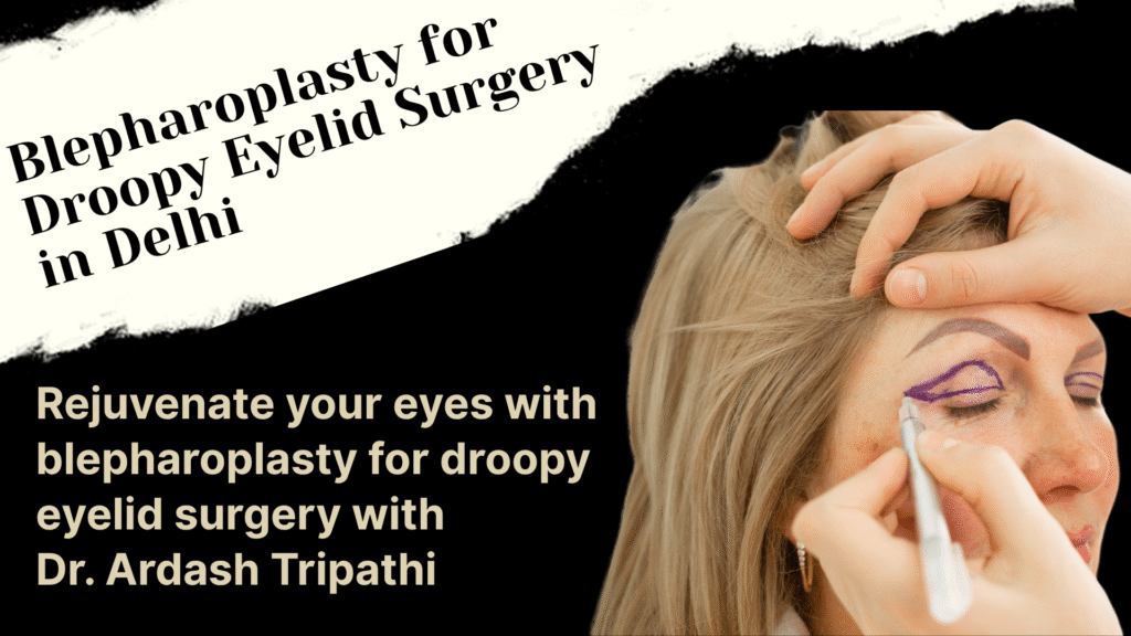 Blepharoplasty for droopy eyelid surgery at Dr. Ardash Tripathi's clinic in Delhi, improving eyelid appearance and vision with a safe and effective procedure for rejuvenated eyes.