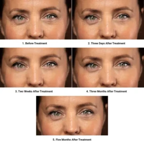 Read more about the article Botox Treatment in Delhi: Your Guide to Finding the Best Botox Doctor