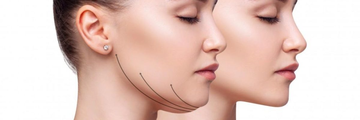 Side view illustrating a refined chin contour achieved through chin enhancement surgery